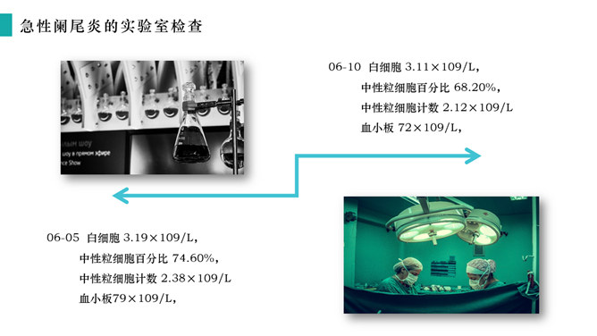 急性阑尾炎护理查房治疗PPT模板