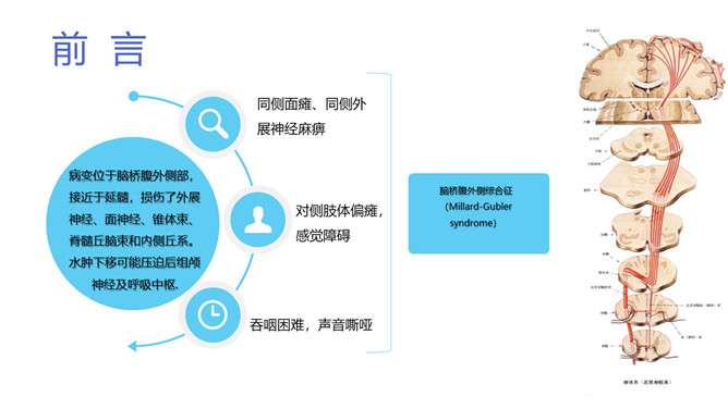 脑出血护理个案分析PPT模板